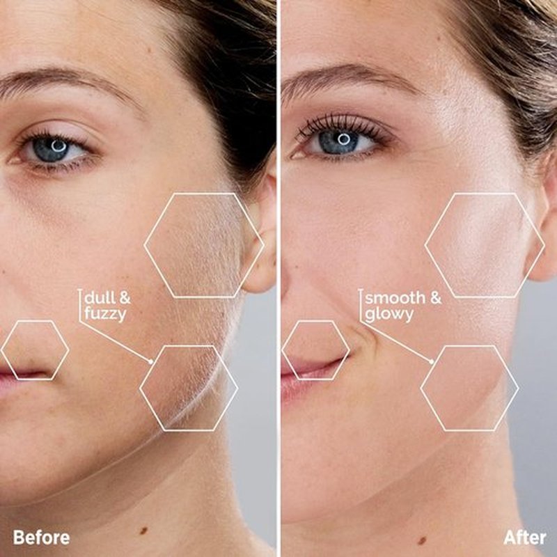 KRADAA Facial Hair Removal for Women: Rechargeable Hair Removal Device - Painless Womens Face Razor Peach Fuzz (White)