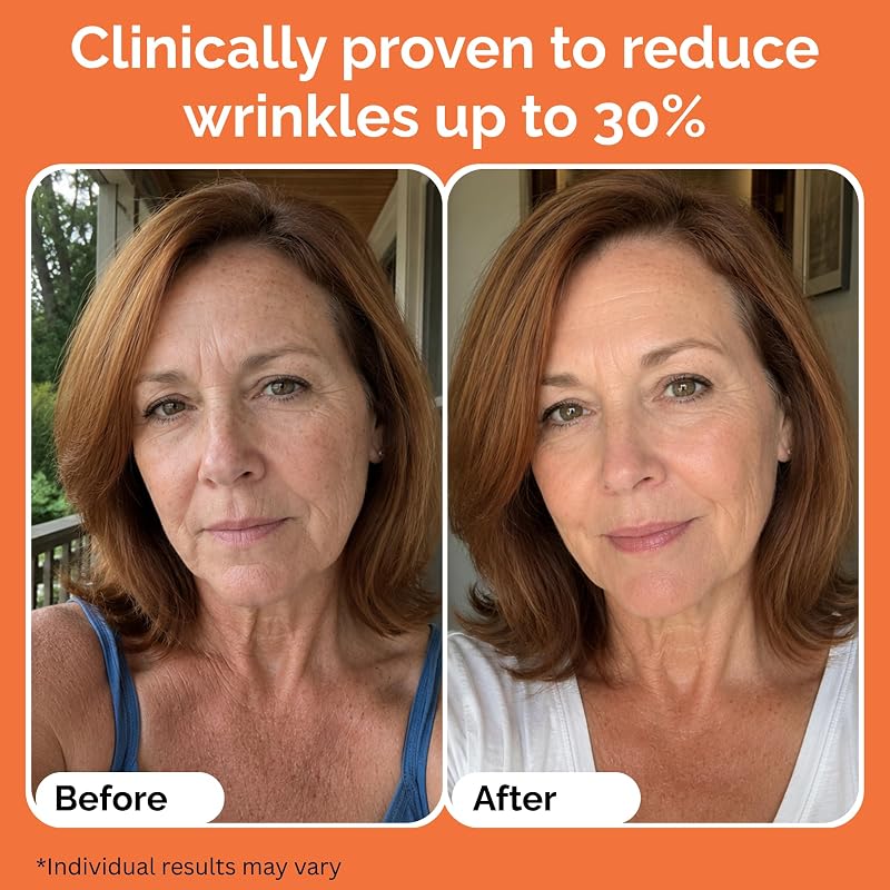 Vitamin C Serum 5% Stabilized with Niacinamide & Biotin - 12 Ampoules 2 mL